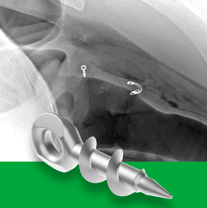 Rings screw for larinx surgery
