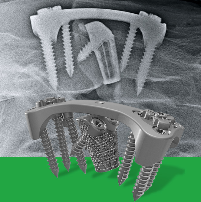 Darkann Max for cervical arthrodesis C2-C6 in horses