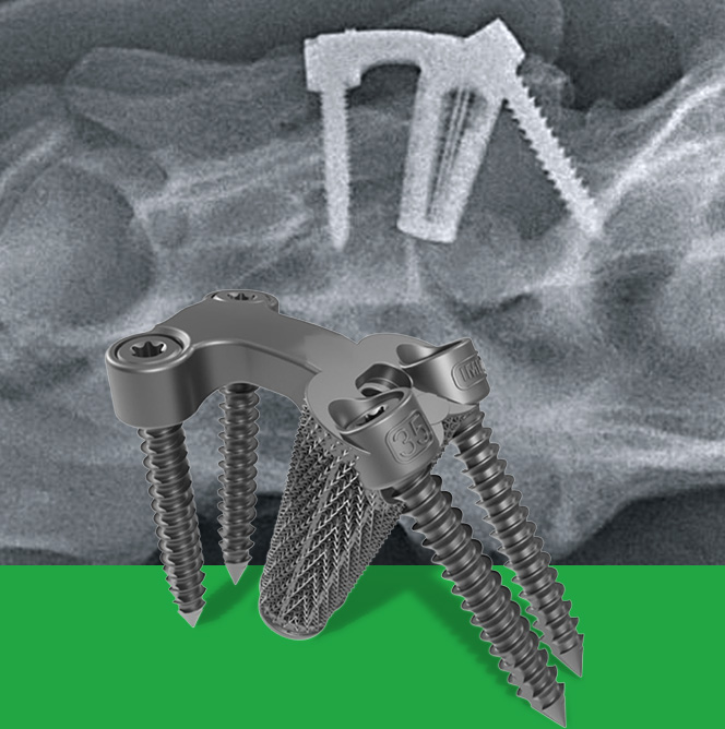Darkann One for cervical arthrodesis C2-C7 in horses