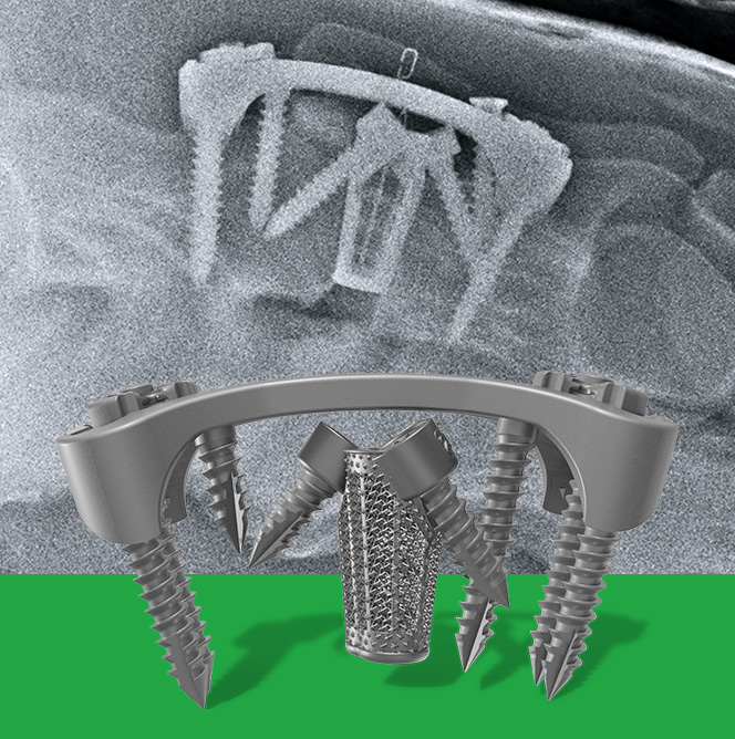Darkann Max for cervical arthrodesis C6-C7 horses