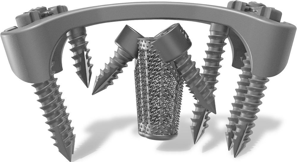 DARKANN MAX implants C6-C7 in horses
